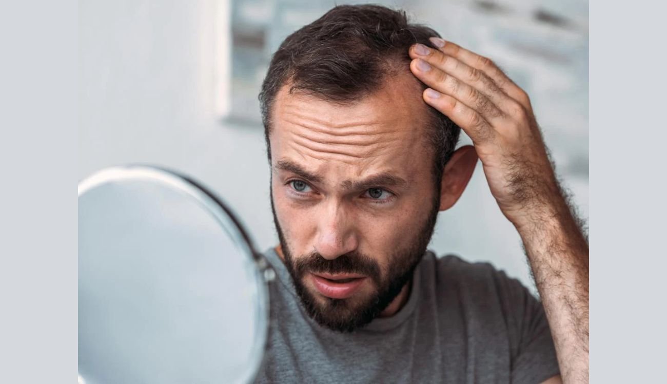 Stress-Induced Hair Fall: How Homeopathy Offers Natural Solution