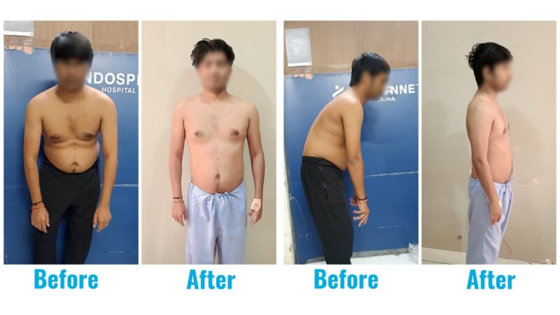 A 31-year-old who lived on a chair… until his spine finally said, ‘Enough’