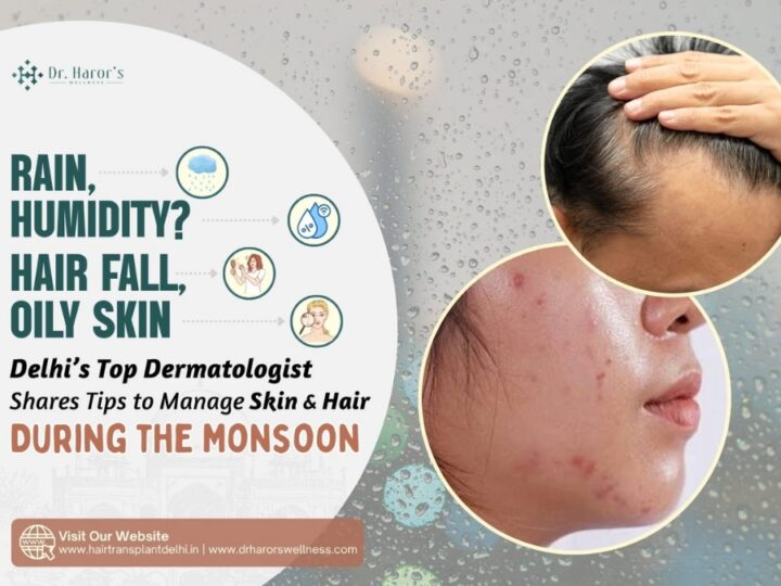 Rain, Humidity, Hair Fall, Oily Skin? Delhi’s Top Dermatologist Shares Tips to Manage Skin & Hair During the Monsoon