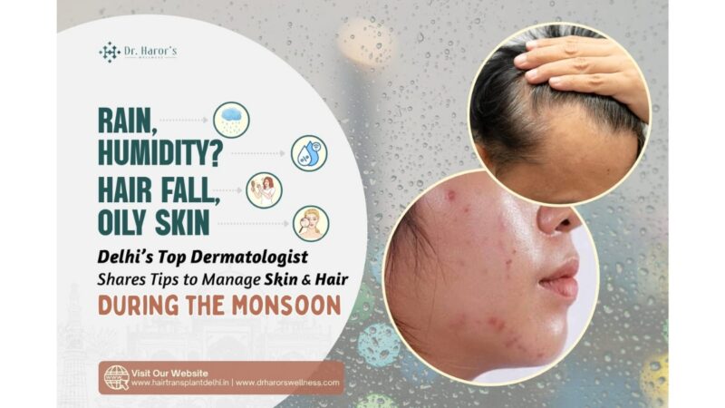 Rain, Humidity, Hair Fall, Oily Skin? Delhi’s Top Dermatologist Shares Tips to Manage Skin & Hair During the Monsoon